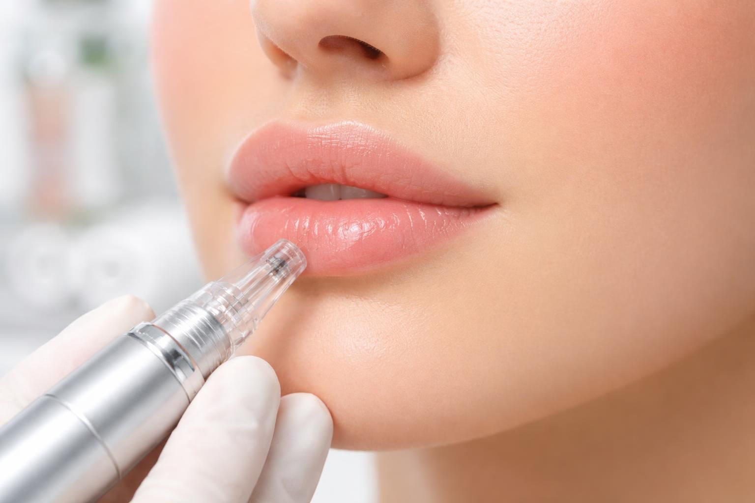 découvrez le microneedling pour les lèvres, une technique sécurisée et efficace pour revitaliser et embellir votre sourire. explications détaillées et conseils pratiques.